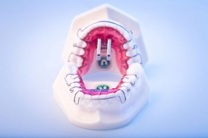 herausnehmbare_apparaturen